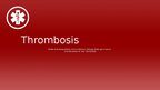 Presentations 'Thrombosis', 1.