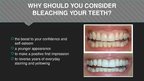 Presentations 'Professional Teeth Bleaching', 2.