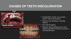 Presentations 'Professional Teeth Bleaching', 4.