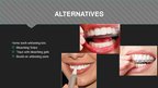 Presentations 'Professional Teeth Bleaching', 11.