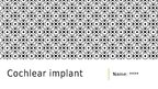 Presentations 'Cochlear Implant', 1.