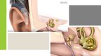 Presentations 'Cochlear Implant', 11.