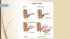 Presentations 'Crohn's Disease', 7.