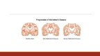 Presentations 'Alzheimer Disease', 3.