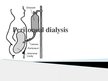 Presentations 'Peritoneal Dialysis', 1.