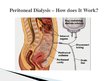 Presentations 'Peritoneal Dialysis', 4.