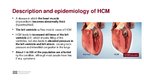 Presentations 'Hypertrophic Cardiomyopathy', 3.