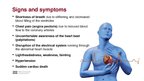 Presentations 'Hypertrophic Cardiomyopathy', 6.